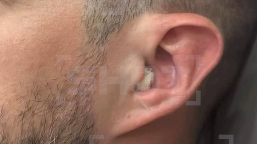 Томич заразился смертельной бактерией и оглох, искупавшись в местной речке. Фото: t.me/shot_shot