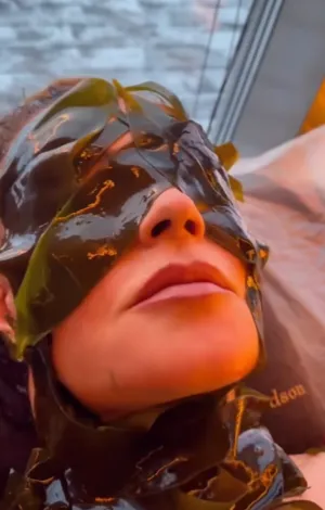 Екатерина Андреева и ее процедуры по омоложению. ФОТО: соцсети