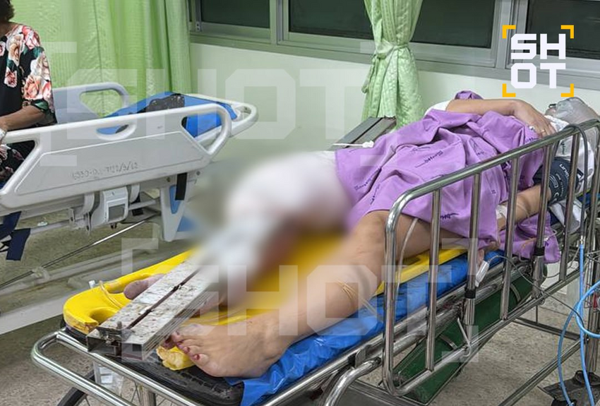 В Таиланде упавшая железная балка насквозь пробила ногу российской туристке. Фото: t.me/shot_shot