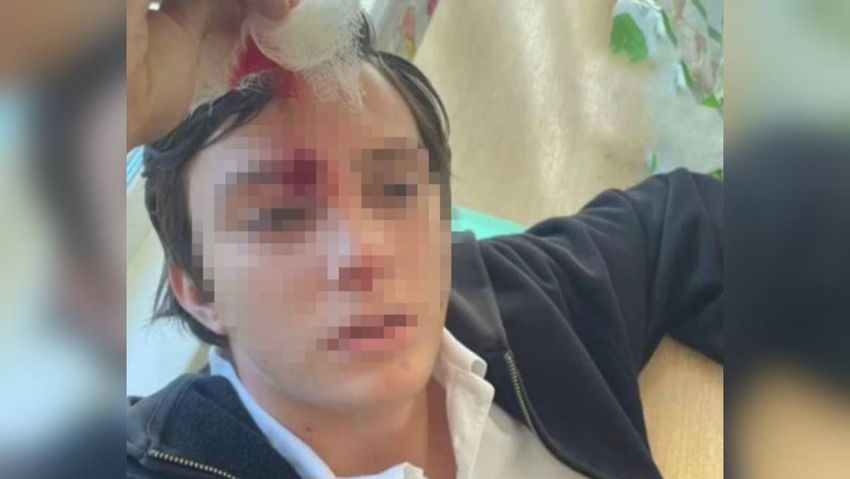В Хабаровске парень, которому одноклассник выстрелил в лоб, боится выходить на улицу. Фото: t.me/amur_mash