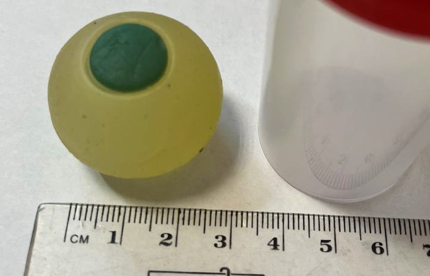 В Челябинске третьеклассник проглотил резиновый глаз, перепутав его с мармеладом. Фото: t.me/url_mash