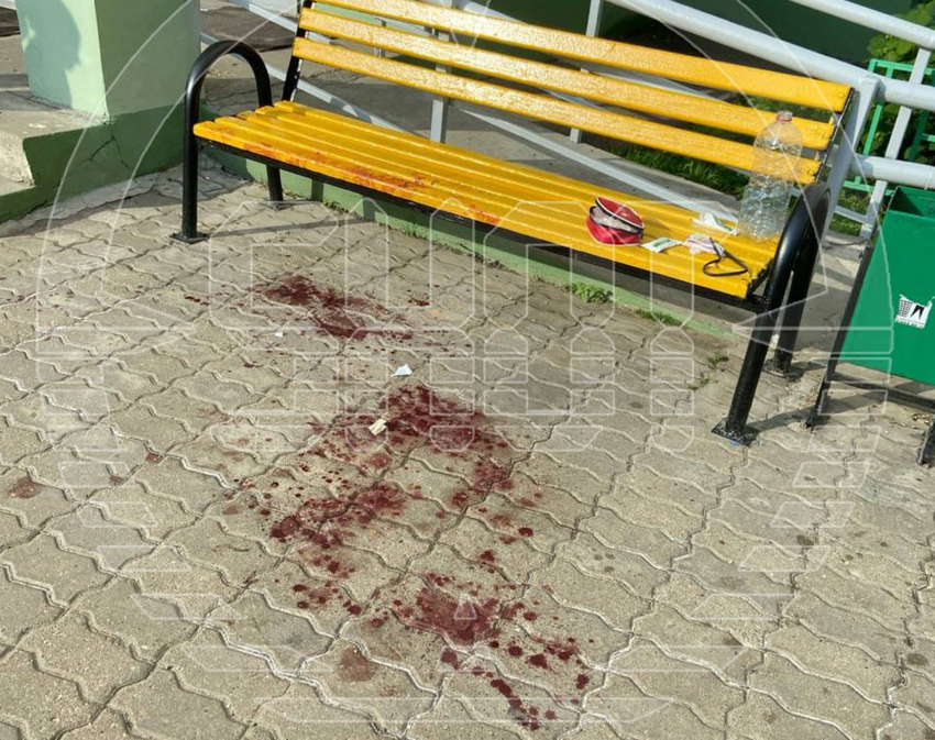 Подросток, отрубивший мачете пальцы новому парню своей бывшей, играл с ним в одной рок-группе. Фото: @t.me/shot_shot