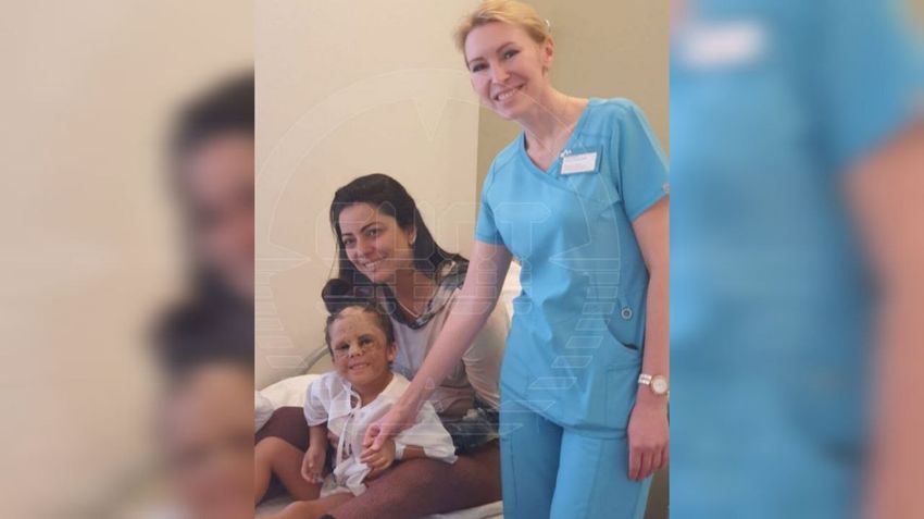 Русские доктора провели девочке с "маской Бэтмена" первую операцию по избавлению от шрамов. Фото: @shot_shot