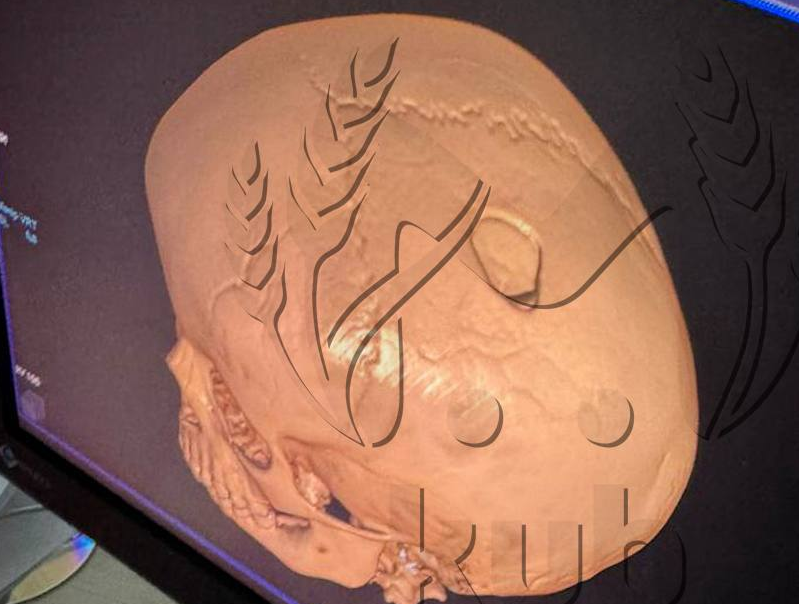 Фото: t.me/kub_mash