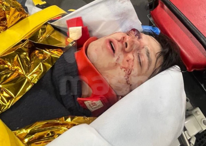 Рэпер Vacio попал в реанимацию в Париже после падения с трёх этажей. ФОТО: @mash