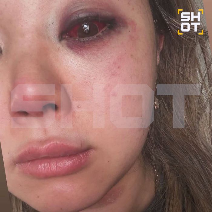 Фото: t.me/shot_shot